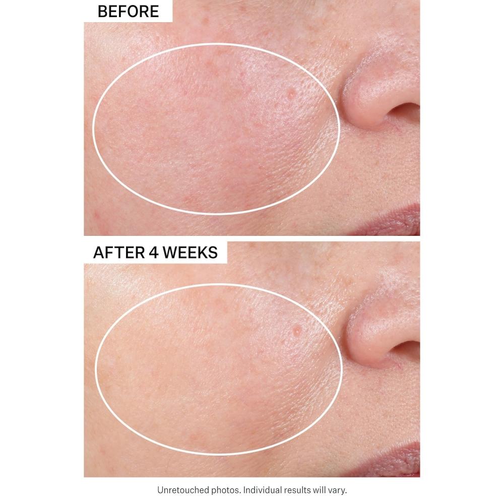 Strivectin Advanced Retinol Nacht-Erneuerungs-Gesichtsfeuchtigkeitscreme mit Retinol