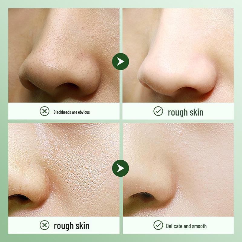 Shangduo Centella Asiatica Night Repair Set: Moisturizing, Hydrating, Rejuvenating Skincare for Delicate Pores