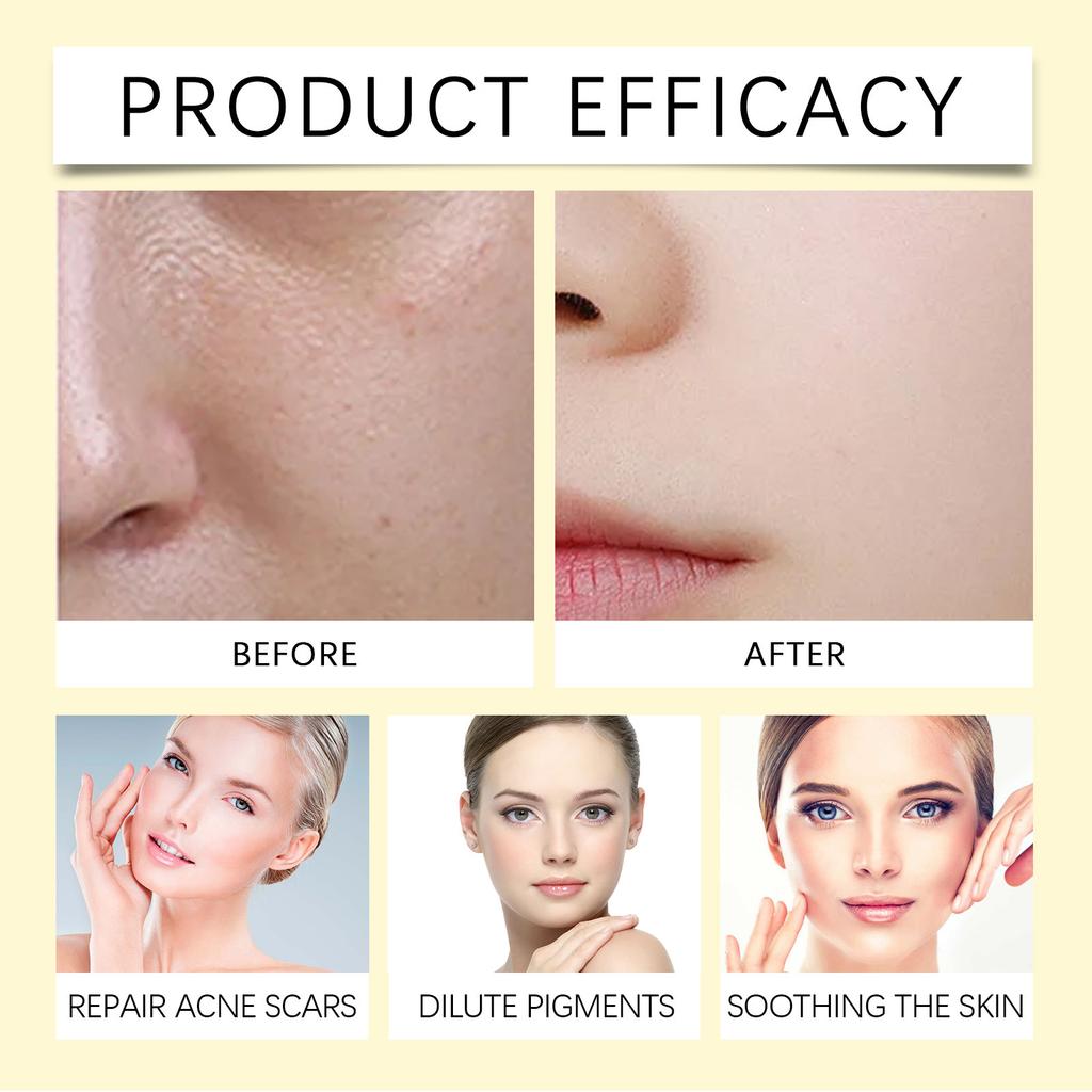 Vitamin B5 Moisturizing Serum Hydrating Essence for Soft, Smooth and Delicate Face