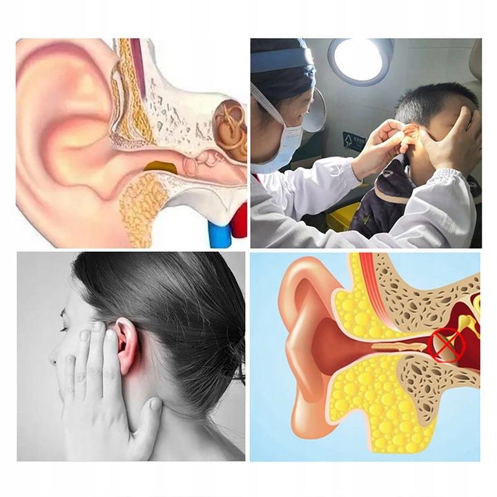 Smart Otoscope Camera Ear Cleaning Wax Wifi Hd Application Endoscope