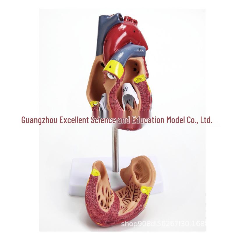 1:1 Human Heart Anatomy Model with 34 Markings, Large Color Doppler B-Ultrasound Mold for Teaching