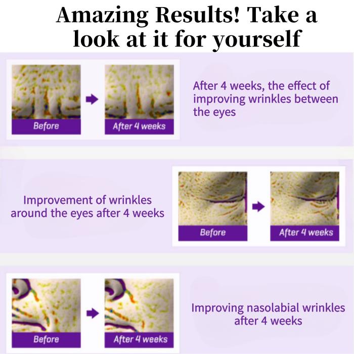 SOME BY MI] Retinol Intense Advanced Triple Action Eye Cream 30ml