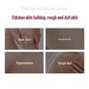 Niacinamide Body Scrub: Tender & White Full-Body Exfoliator for Chicken Skin, Hand Scrub, Large Clinic-Use Bottle.