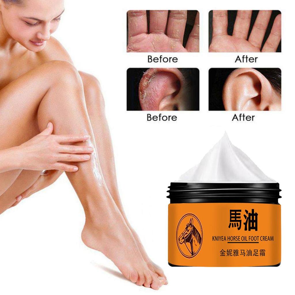 Foot Cream Heel Crack Repair Cream Dead Skin Removing Hand and Foot Care Moisturizing Cream