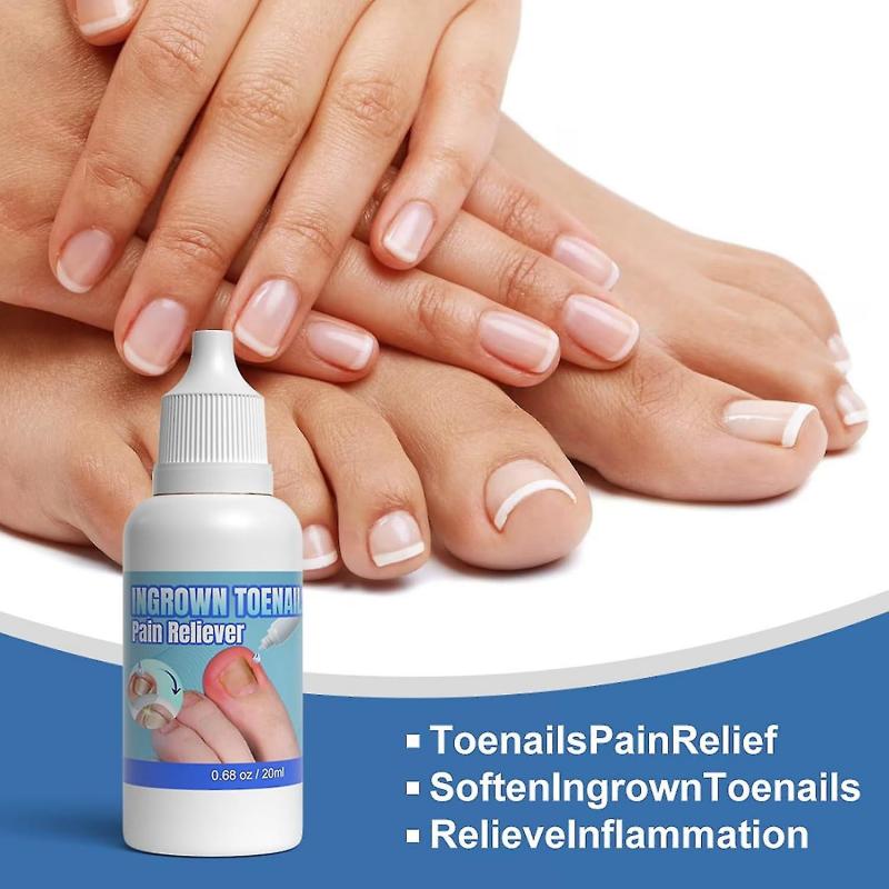 Ingrown Toenail Treatment Extra Strong, 20ml Ingrown Toenail Drop, Cuticle Care Oil for Ingrown Toenails, Fungal Nail Treatment