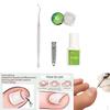 Ingrown Toenail Strips Brace Straightener Clip Curved Toenails Thick Correction Foot Tool with