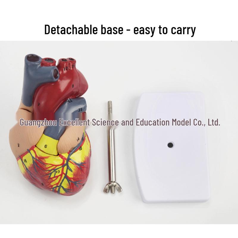 1:1 Human Heart Anatomy Model with 34 Markings, Large Color Doppler B-Ultrasound Mold for Teaching