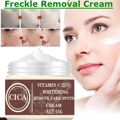 Repair and Lighten Freckles, Remove Dark Spots, Melanin Remover, Brightening Facial Cream