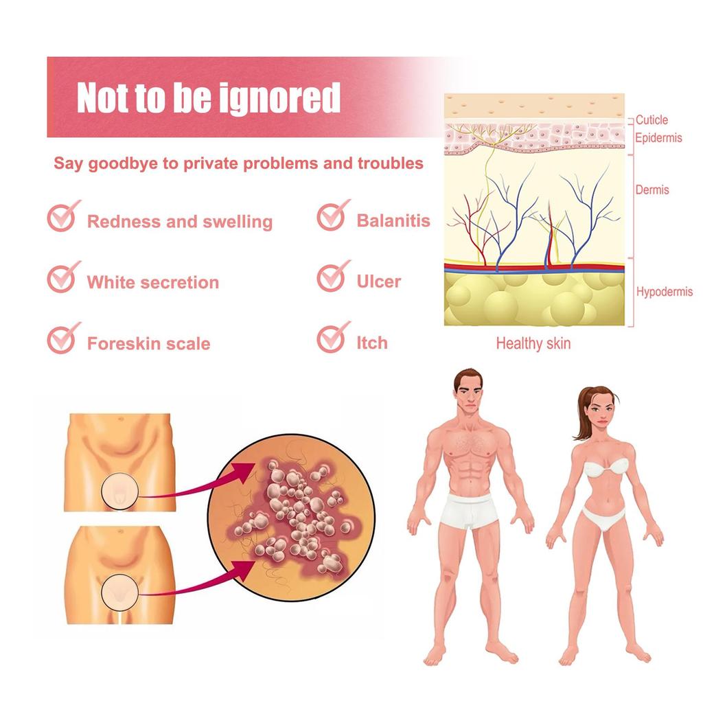 SouthMoon Inner Leg Balm Women's Private Parts Odor Removing, Moisturizing, Skin Repairing Balm