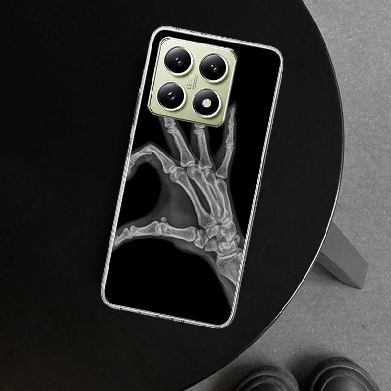 Autumu X Ray Hand Bones Phone Case Cover for Xiaomi Redmi Note 15 14 13 12 11 Pro Plus 14S 12S 11S 11T 11E 10S 10 Customized Fun