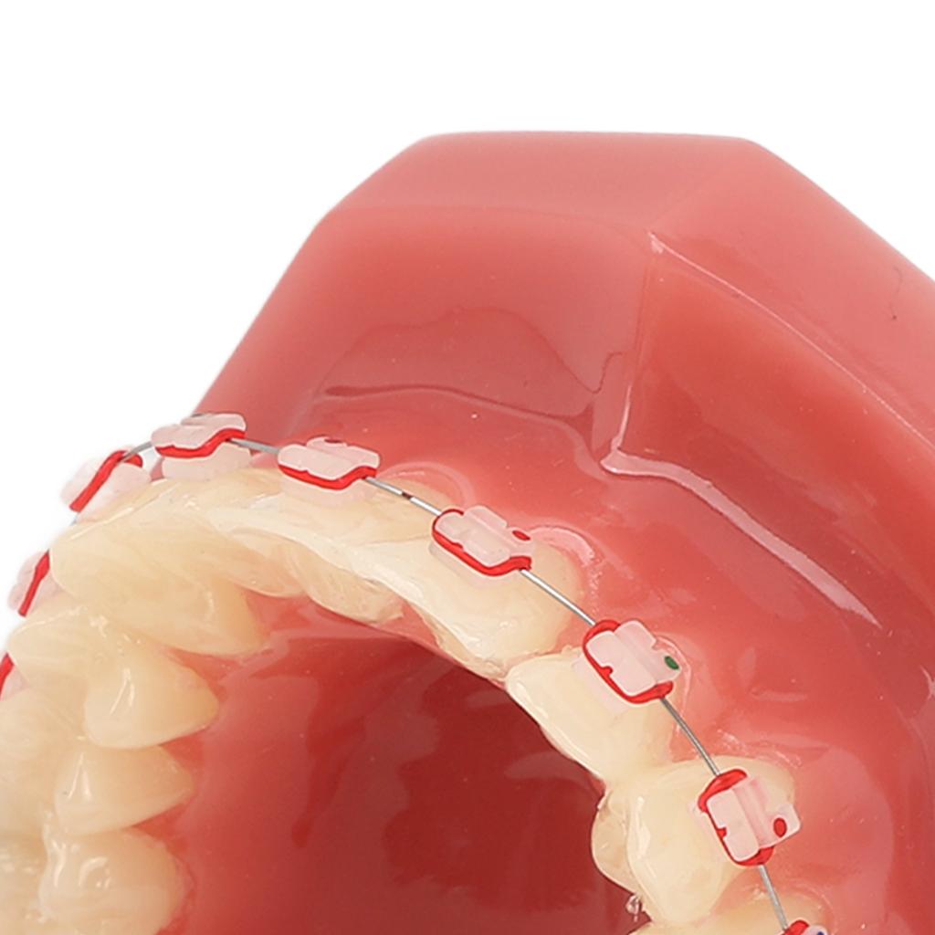 Ceramic Dental Orthodontic Demonstration Model Teeth Model with Metal Wires and Bracket for Teaching Learning