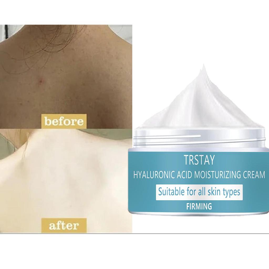 Brightening, Whitening and Moisturizing Cream, Evenly Skin Tone, Repairing Damaged Skin, Nourishing and Hydrating Moisturizing Cream