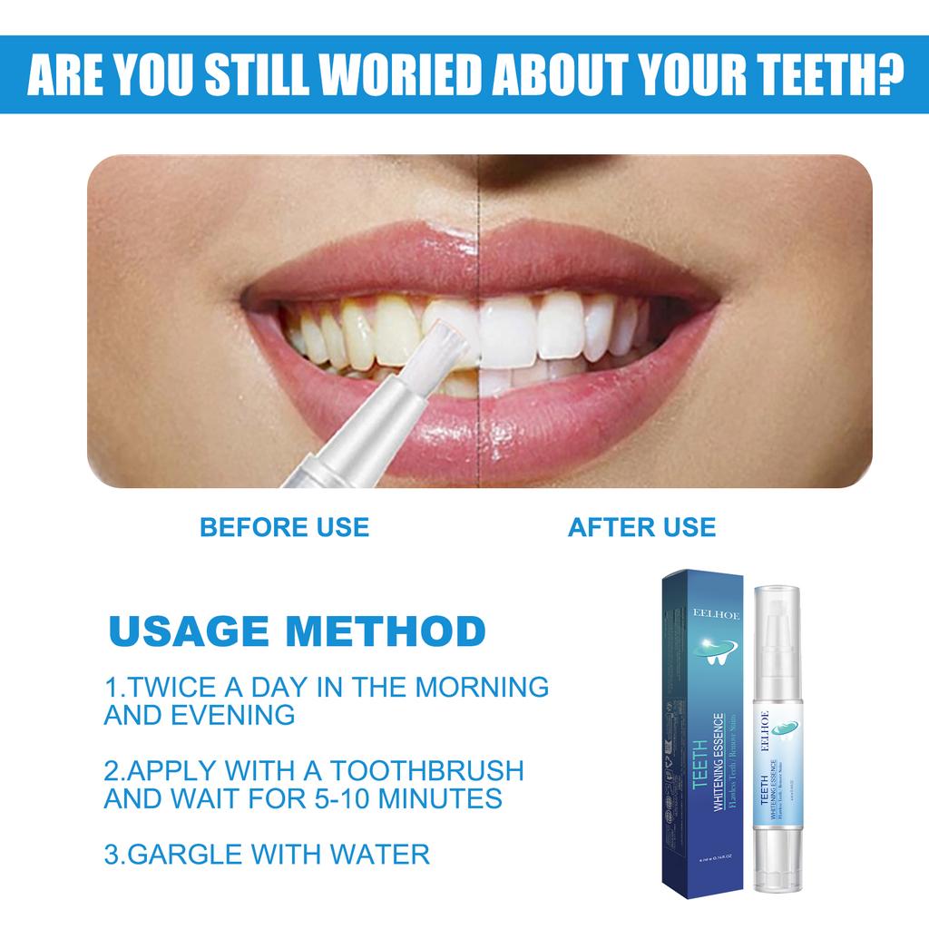 Teeth Cleaning Pen Deeply Cleanses and Whitens Teeth, Freshens Breath, Removes Plaque.