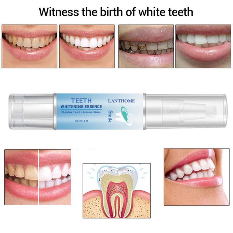 Buy Lanthome Teeth Whitening Pen Tooth Brush Essence Oral Hygiene