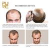 PURC Haarwachstumsprodukte, Ingwer-Haarspray, schnell wachsendes Haaröl, Haarausfall-Pflegespray, Schönheitsbehandlung für Haare und Kopfhaut, für Männer und Frauen, 30 ml
