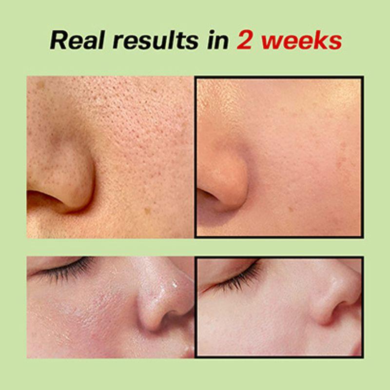 SUNGBOON EDITOR Green Tomato Pore Lifting Ampoule+ 30ml