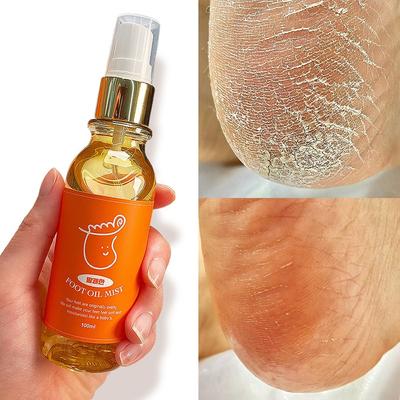 Refreshing Foot Oil Mist, Foot Odor, Itchy Soles, Toes, Heels, Dead Skin Cells Moisturizing, 1 Piece, 1 Piece