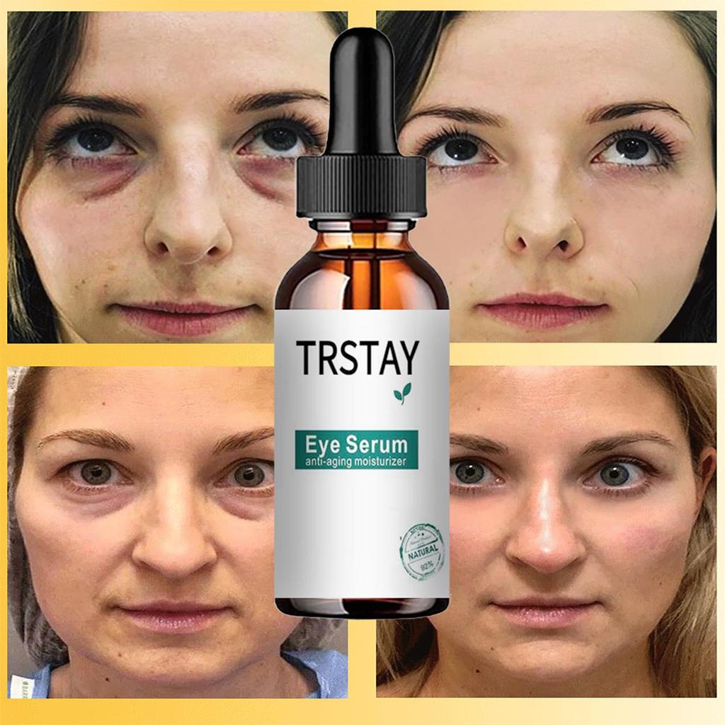 Sérum pour les yeux, Anti-rides, Anti-âge, blanchissant, éclaircissant, cernes, Essence de soin contre les poches et les poches, 5ML/15ML/30ML/50ML