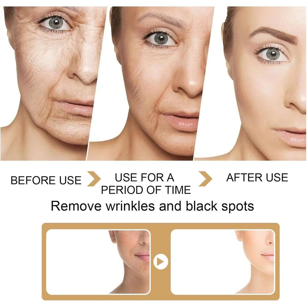 Turmeric Dark Spot Corrector Serum, Natural Turmeric Dark Spot Corrector Serum for Face, Skin Care Moisturizing Serum, Formulated with hyaluronic acid