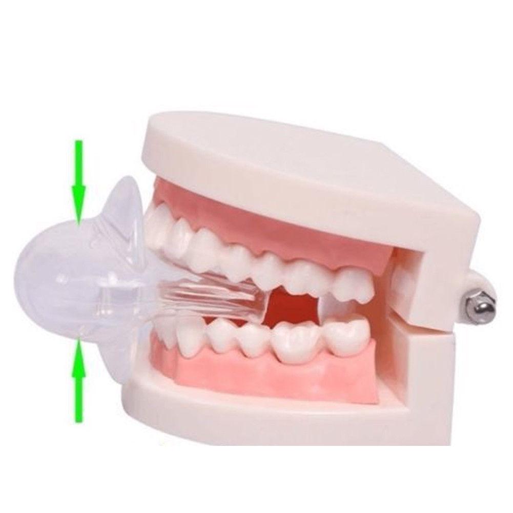 Dispositivo antirronquidos tipo boca que alivia los ronquidos Dispositivo  antirronquidos creativo comprar a buen precio — entrega gratuita, reseñas  reales con fotos — Joom, image size:1001x1001