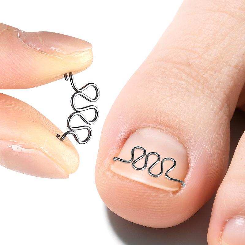 1 Pcs Ingrown Toenail Correction Tool Ingrown Toenail Treatments Elastic Patch Sticker Toenail Straightening Pedicure Tools