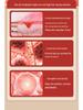 LED Infrared Light Therapy Lamp for Full-Body Skin Care and Whitening