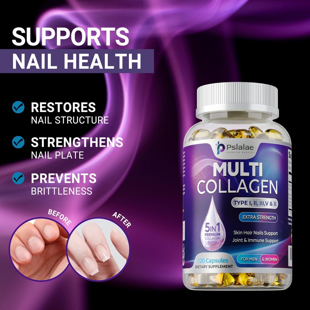 Pslalae Collagen Softgels, a natural hydrolyzed collagen peptide supplement, support hair, skin, nail, and joint health.