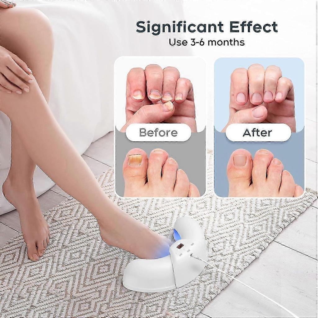 Portable Nail Fungus Laser Treatment Device - 905nm Infrared & 470nm Blue Dual Light Therapy for Toenails Fingernails