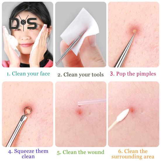 Blackhead Remover Tool Kit Professional Blackhead Extractor with Case And 5x Magnifying Glass for Pimples Blackheads Zit Removing Forehead Facial Nose