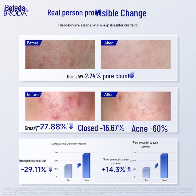 

Borrada Nourishing & Acne Treatment Mask