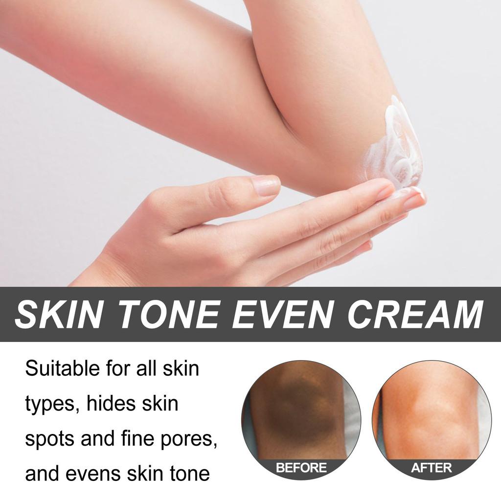 Strahlende Aufhellende Hautcreme Für Achseln Ellenbogen Gelenke Dunkle Flecken Nährender Feuchtigkeitsspender