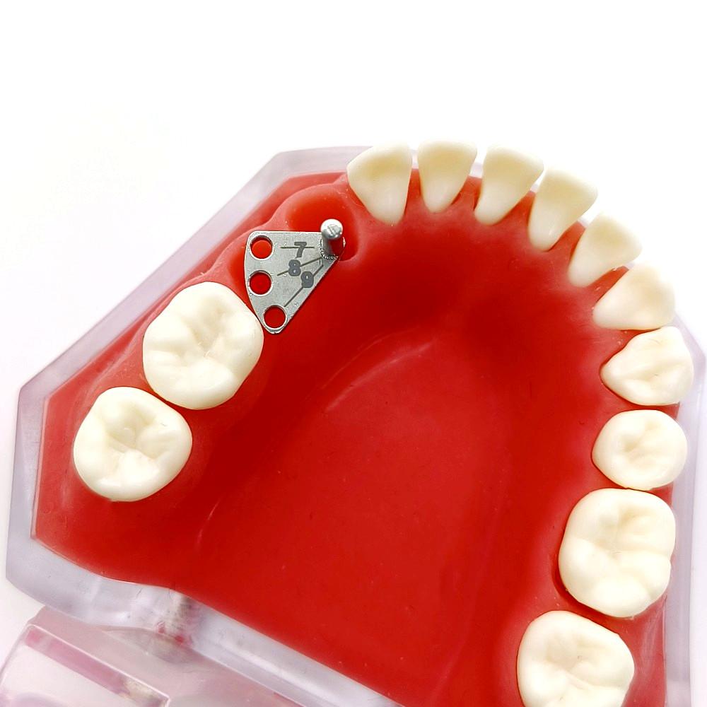 Dental Implant Parallel Pin Gauge Stainless Steel Lacator Dental Implant Locatring Guide Locating Ruler