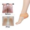 5 Pairs Gel Heel Sleeves, Breathable Silicone Heel Socks Protectors To Repair Dry Cracked Heel and Reduce Pains