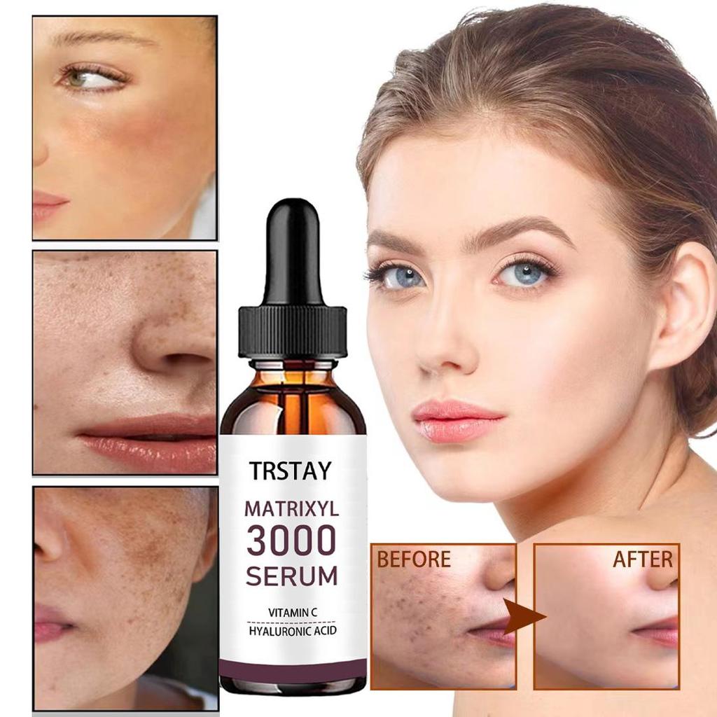 5ML/15ML/30ML/50ML/TRSTAY Ultimate Wrinkle-Reducing Face Serum for Radiant Skin