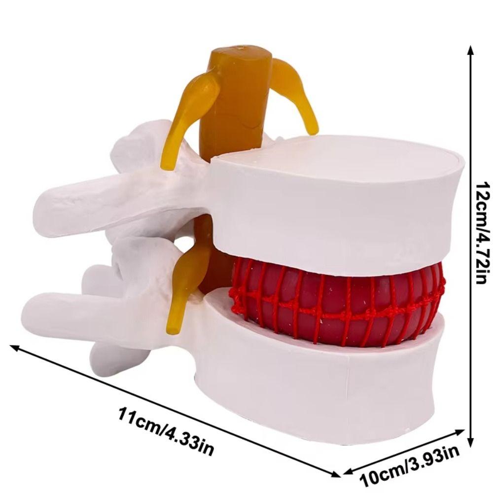 3D Model Lumbar Model Spine Demonstration Structure  Teaching Demonstration