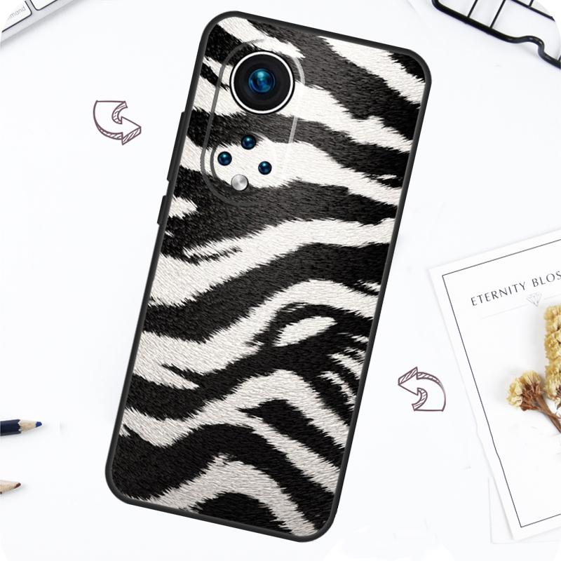 Zebra Skin Print Case For Honor Magic 7 5 6 Pro Honor 200 Pro X9b X9a X8b X8a X8 X9 X9c 50 70 90 Lite Cover