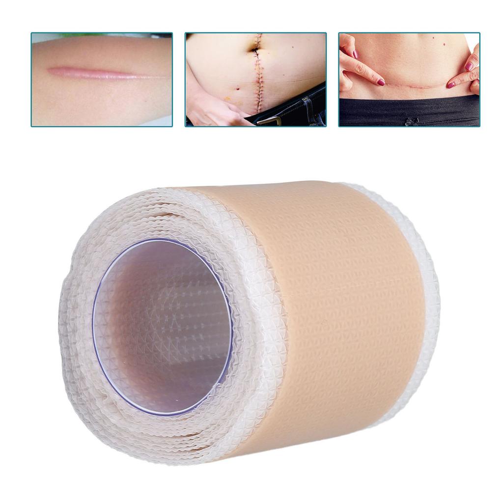 Scar Removal Gel Tape Reusable Breathable Self Adhesion Scars Treatment Tapes 59.06in