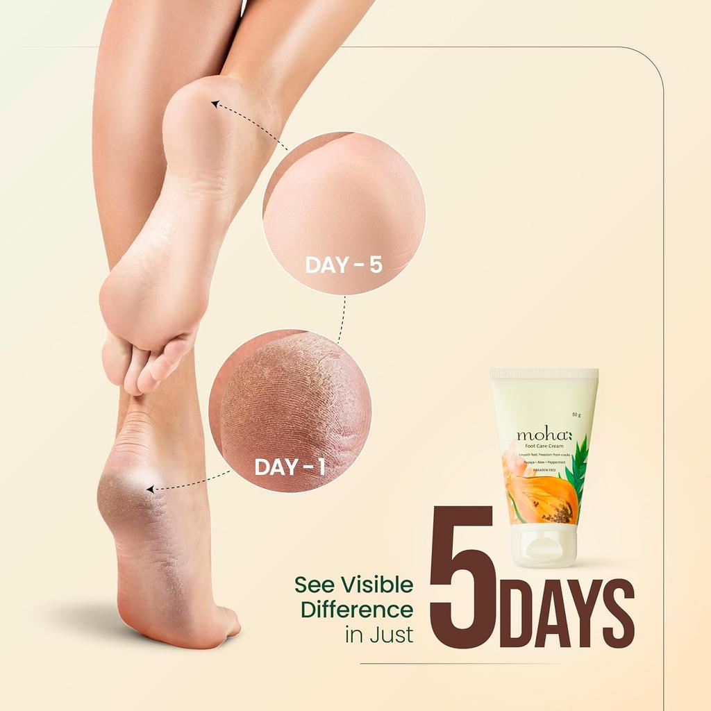 MOHA Foot Cream for Dry Cracked Feet 50gmX  Pack of 2 | Deep Nourishment, Cooling & Vegan Heel Repair Cream