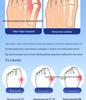 Adjustable Hallux Valgus Corrector for Foot Comfort and Alignment
