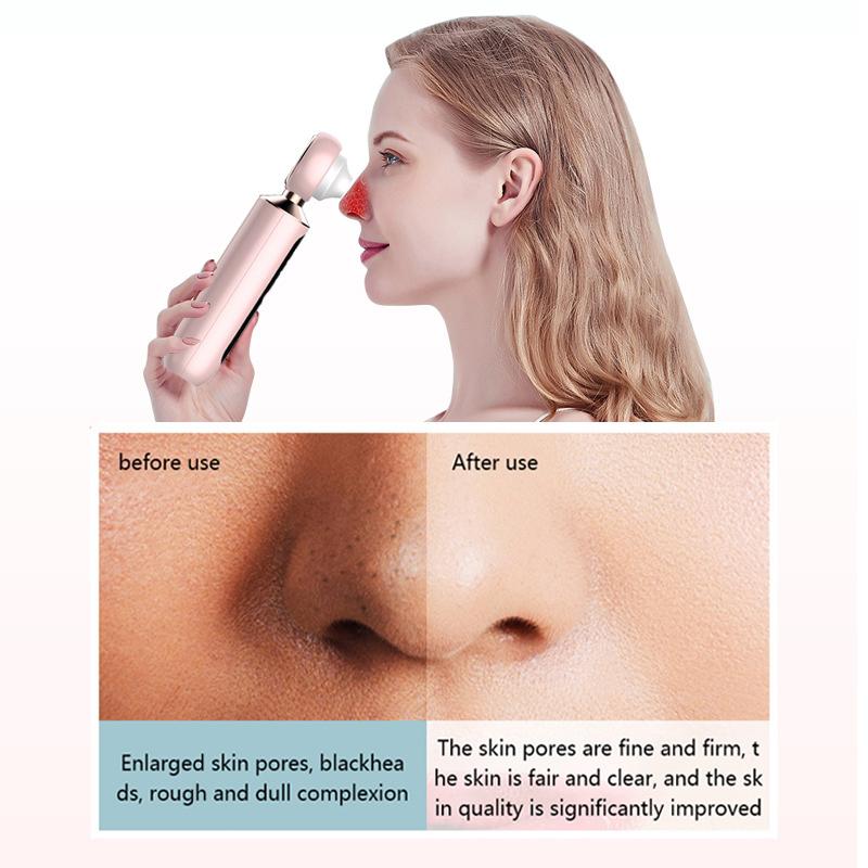 Magnifying glass visual blackhead remover electric blackhead remover strong suction pore cleaner blackhead acne