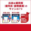 Camtect Gum Care Toothpaste, Prevents Periodontal Disease (Gingivitis and Pyorrhea), 115g (x 1)