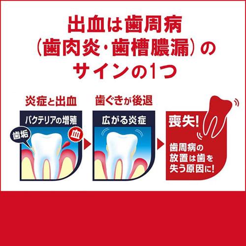 Camtect Gum Care Toothpaste, Prevents Periodontal Disease (Gingivitis and Pyorrhea), 115g (x 1)