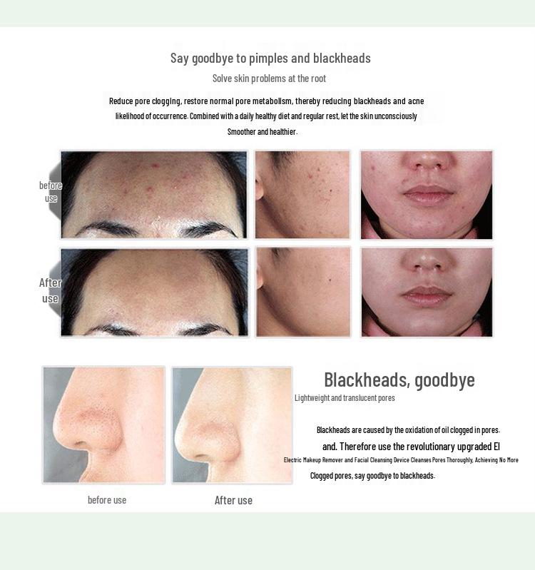 Waterproof Electric Facial Cleansing Brush - Blackhead Remover & Pore Cleaner