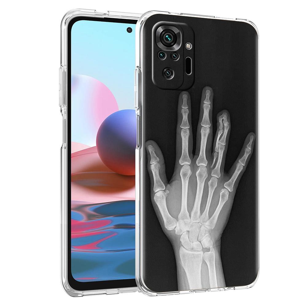 Transparent Phone Case for Redmi 14C 13C 10C 10 9 Note 13 12 11 K50 K40 Plus Pro 4G 5G Soft TPU Cover Autumu X Ray Hand Bones
