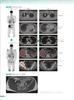 Cancer Interpretation Reports and Comprehensive Imaging Diagnosis Using PET