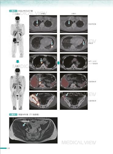 Cancer Interpretation Reports and Comprehensive Imaging Diagnosis Using PET