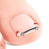 Narzędzie do Pedicure na Wrastające Paznokcie u Stóp Wkładka Pielęgnacja Paznokci u Stóp Prostowanie Korekcyjne Klips Zakrzywiony Zacisk Narzędzie do Korekcji Paznokci u Stóp
