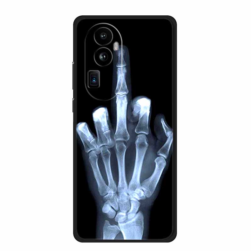 For Blackview Shark 9 5G Case Animals Soft Silicone TPU Phone Cases Back Cover for Blackview Shark9 Fashion Shockproof Fundas