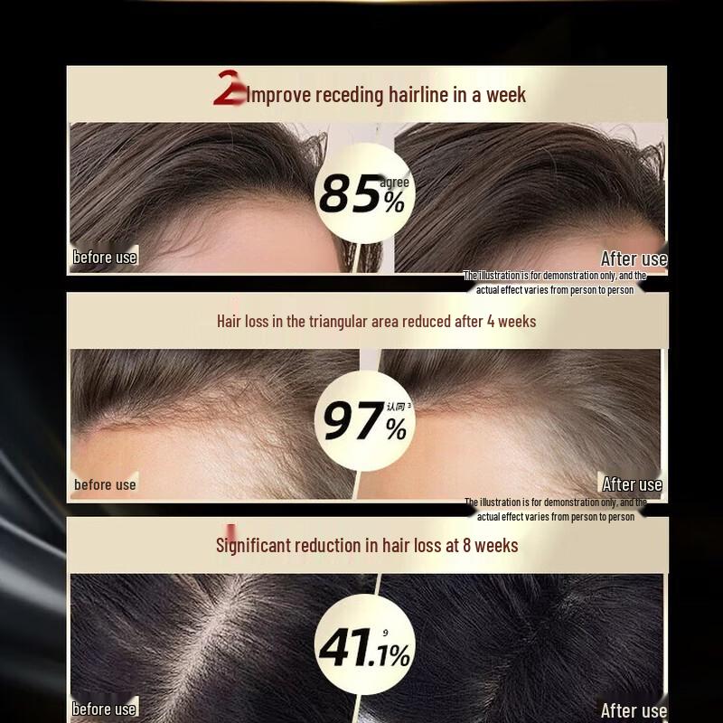 Schwarzkopf Anti-Hair Loss & Oil Control Shampoo