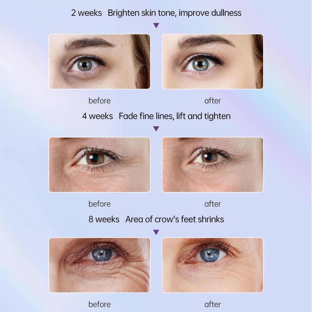 AUQUEST Ultra Light Whitening Eye Cream Reduces Dark Circles Removes Dark Spots Evens Out Skin Tone Reduces Fine Lines 20 Grams